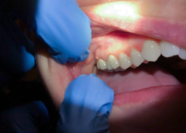 Best Urgent Tooth Repair  in Cloverleaf, TX