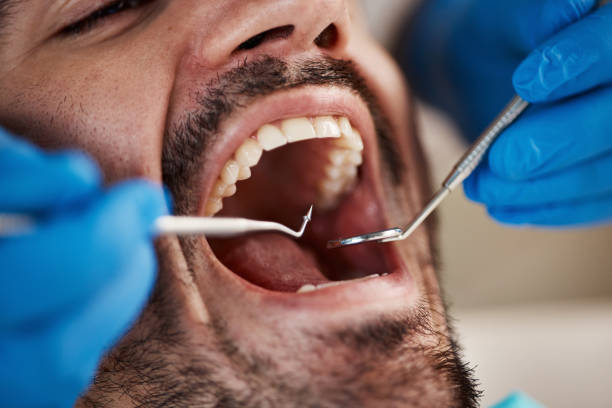 Dentist for Dental Trauma in TX